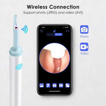 VIFRE™ EARCLEANER PRO